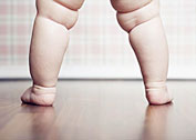 怎样根据症状科学辨别儿童肥胖症